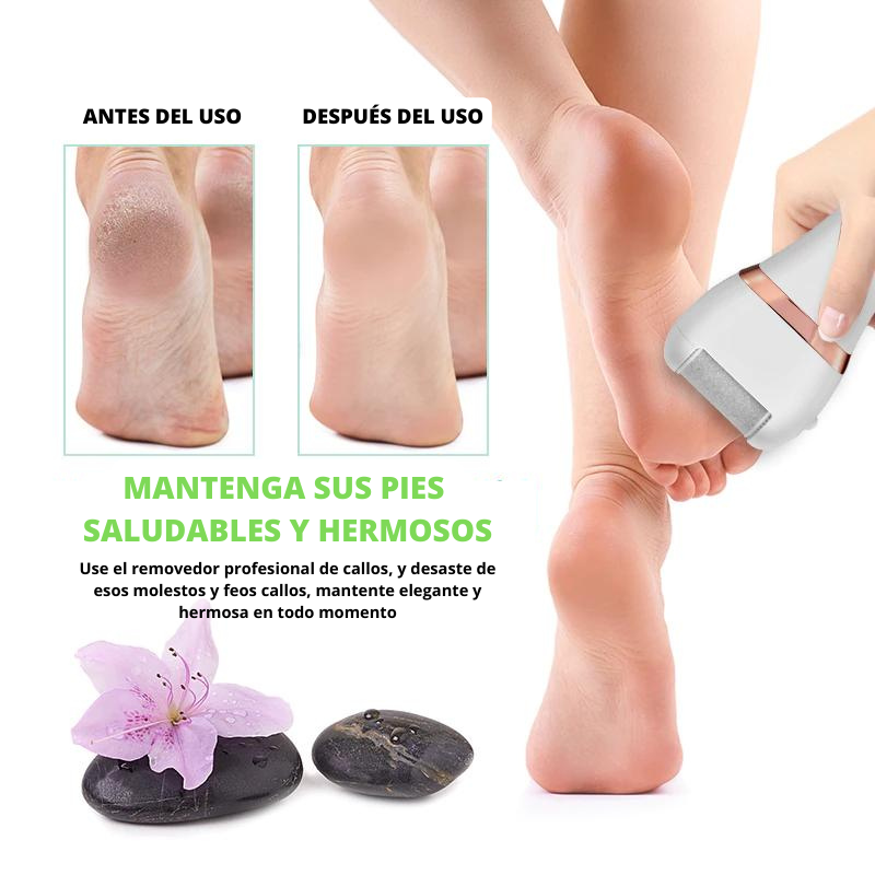 Removedor de Callos 🦶 Recargable USB 🔋
