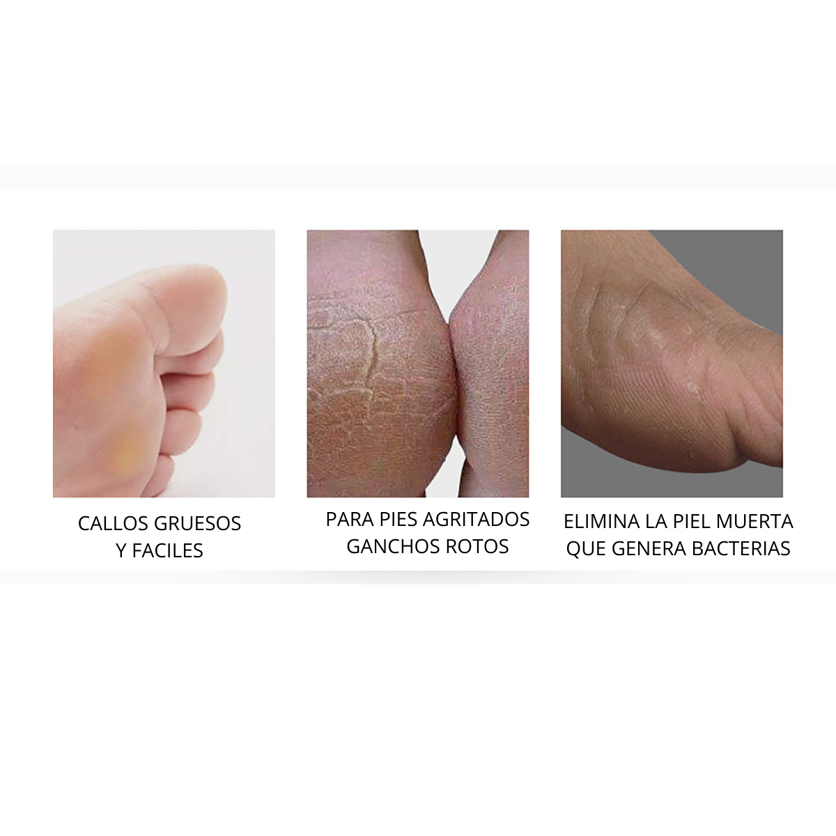 Removedor de Callos 🦶  Electrico Recargable 🔋