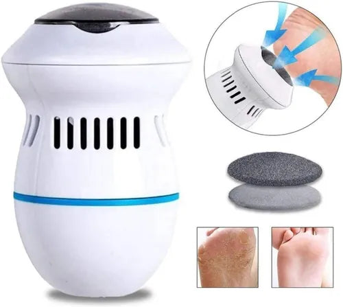 Removedor de Callos 🦶  Electrico Recargable 🔋