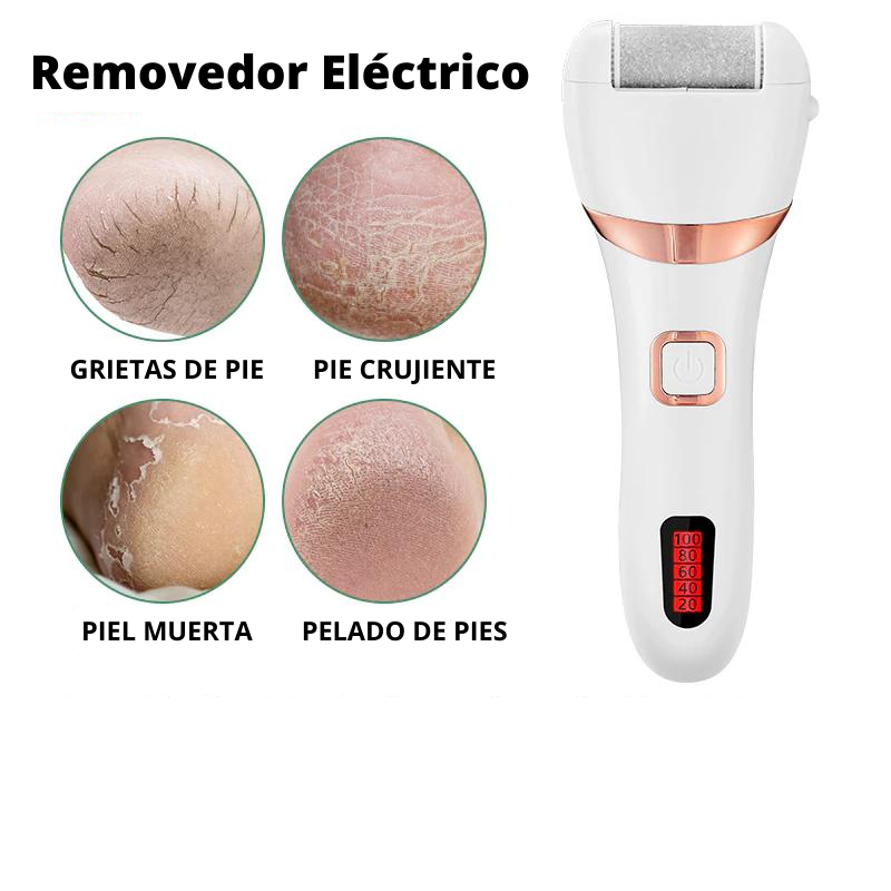 Removedor de Callos 🦶 Recargable USB 🔋